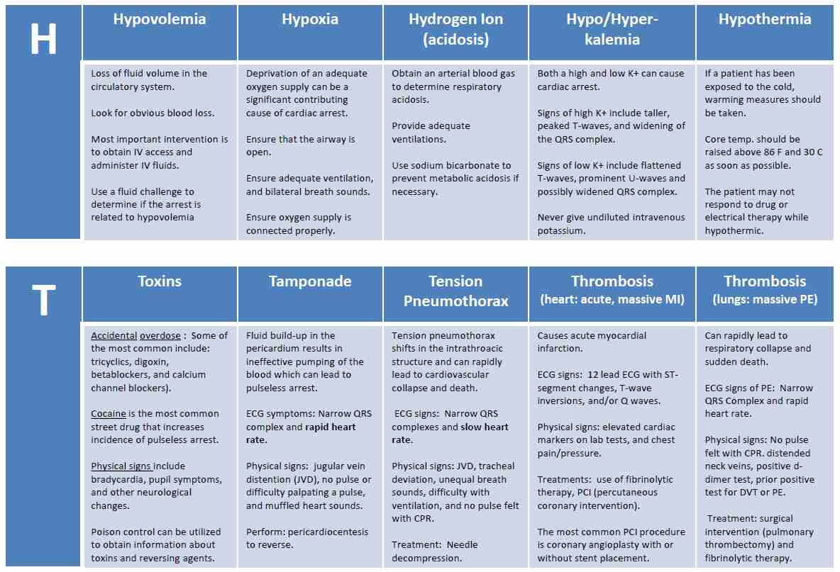 ECG Ventricualr tachycardia Monomorphic VT ecg t